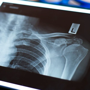 img-service-radiología
